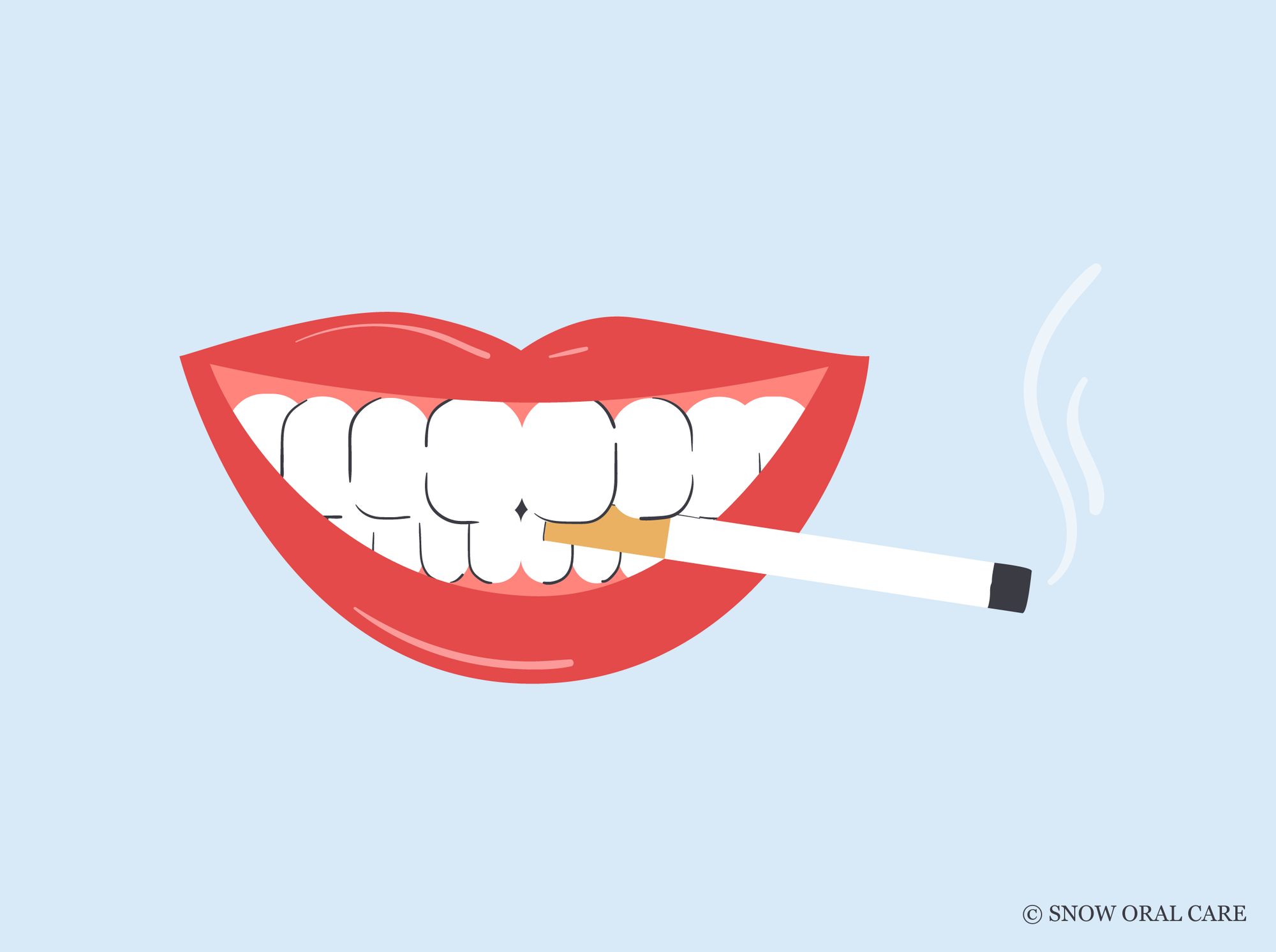 smoking after teeth whitening 