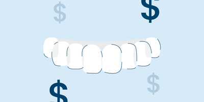 snap on veneers types and costs