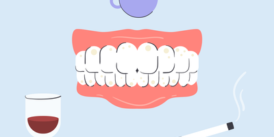 stained teeth causes