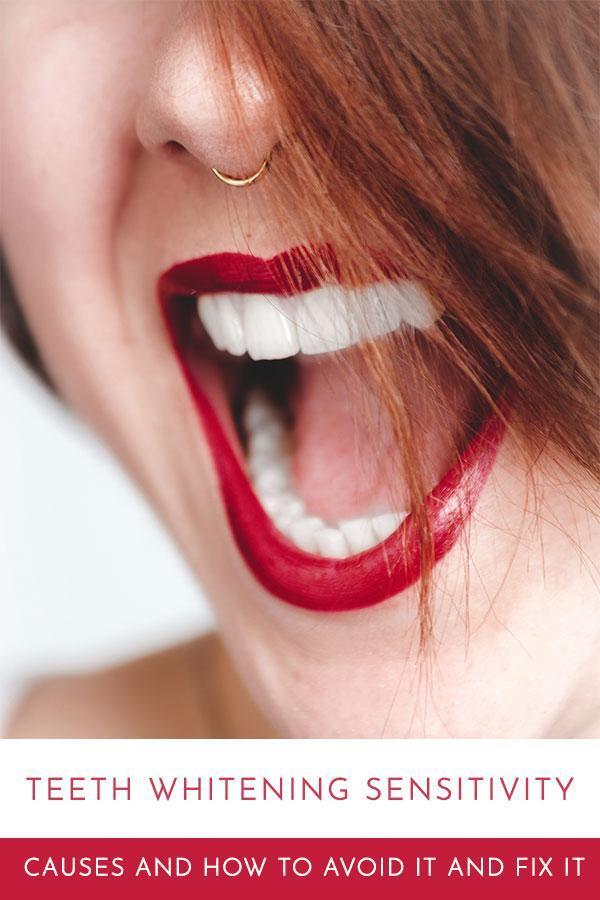 Teeth Whitening and Sensitivity: A Complete Guide Based on Latest Research