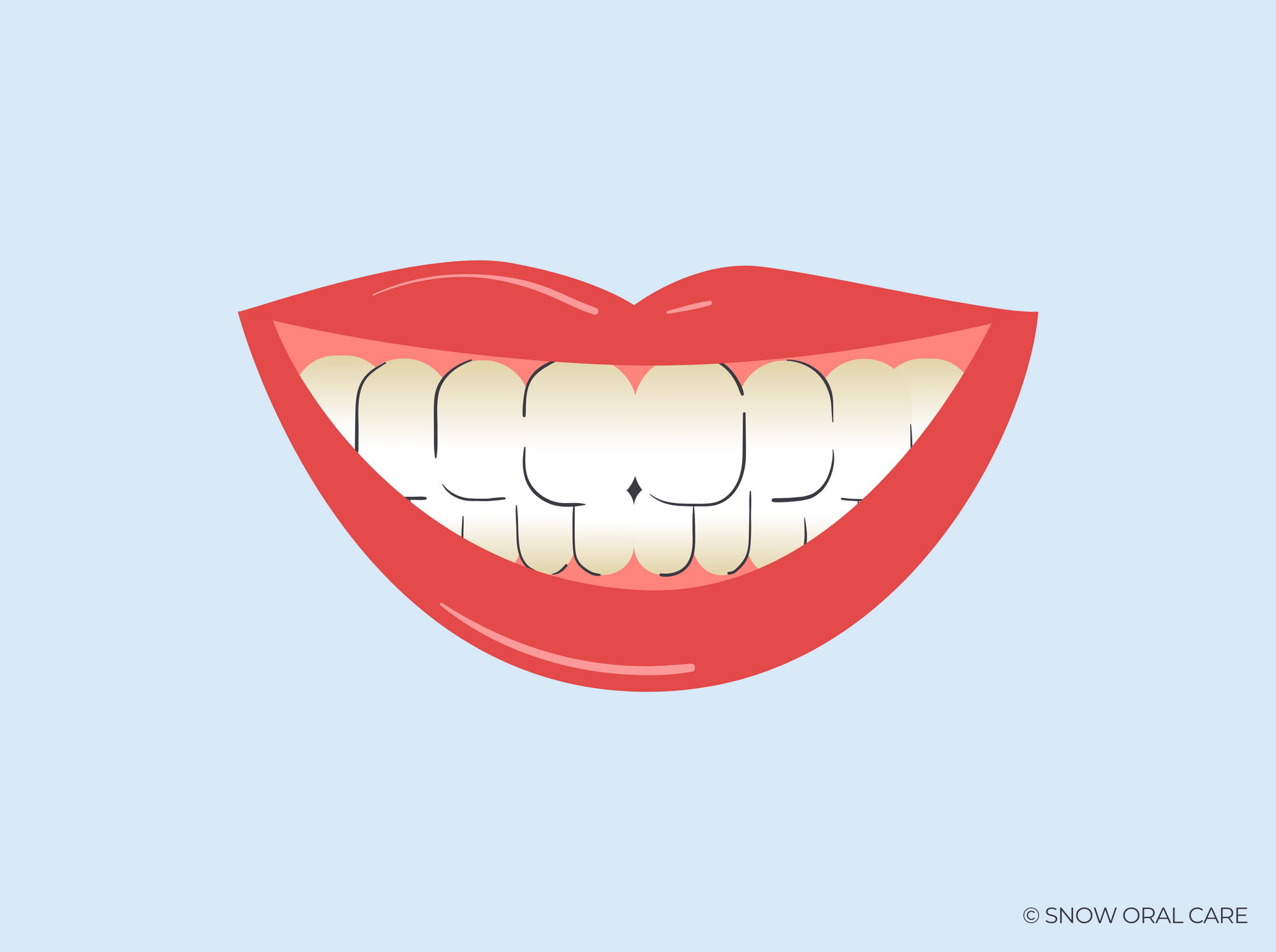 teeth not whitening near gums 