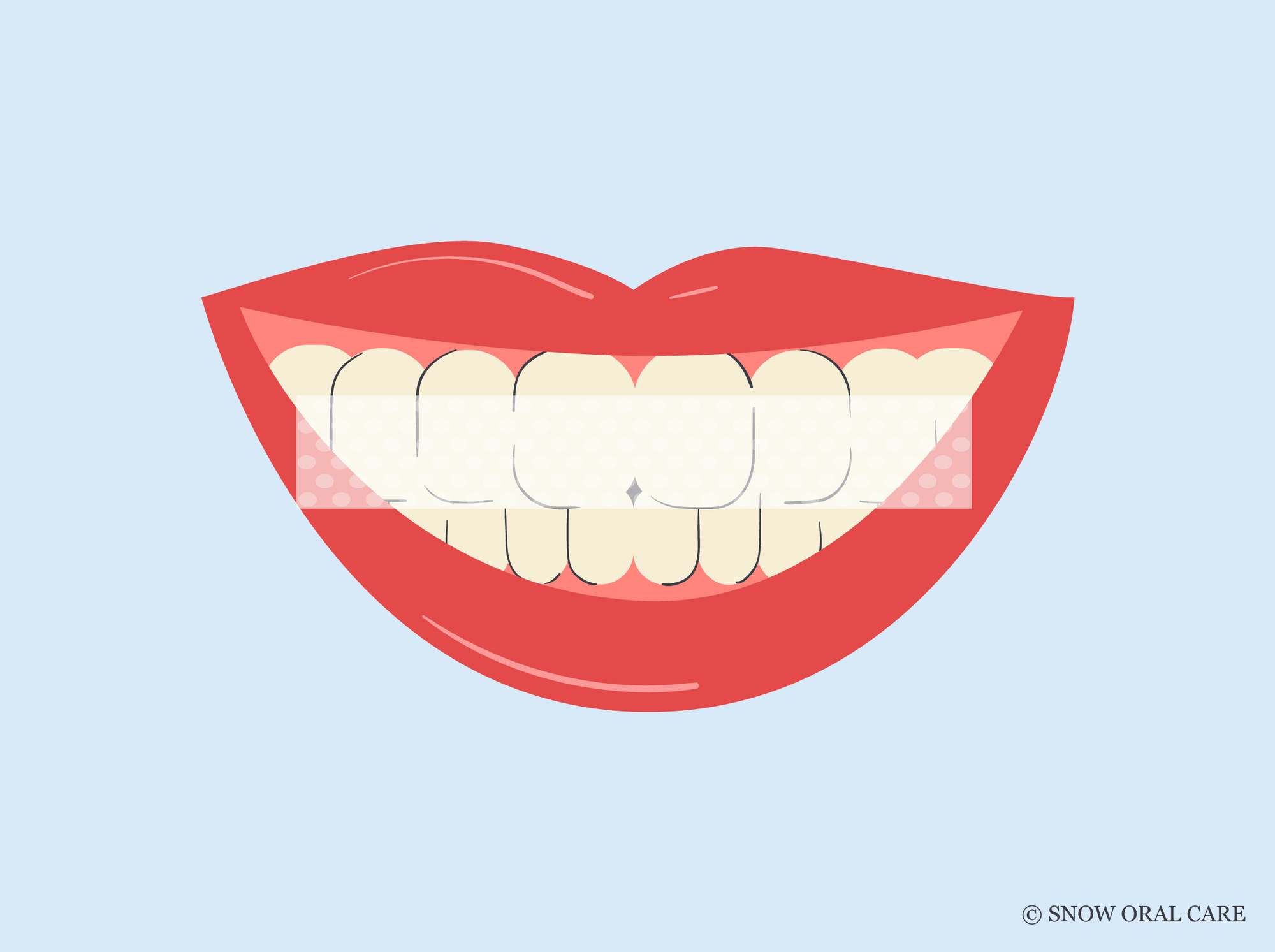 teeth still yellow after whitening 
