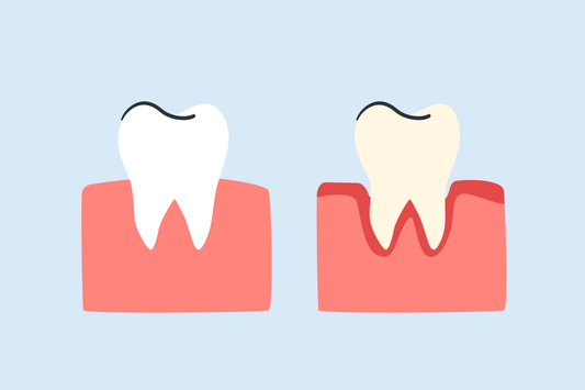 teeth whitening for periodontal disease 