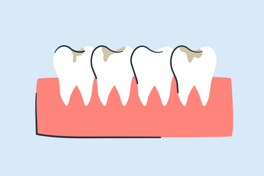 teeth whitening with cavities 