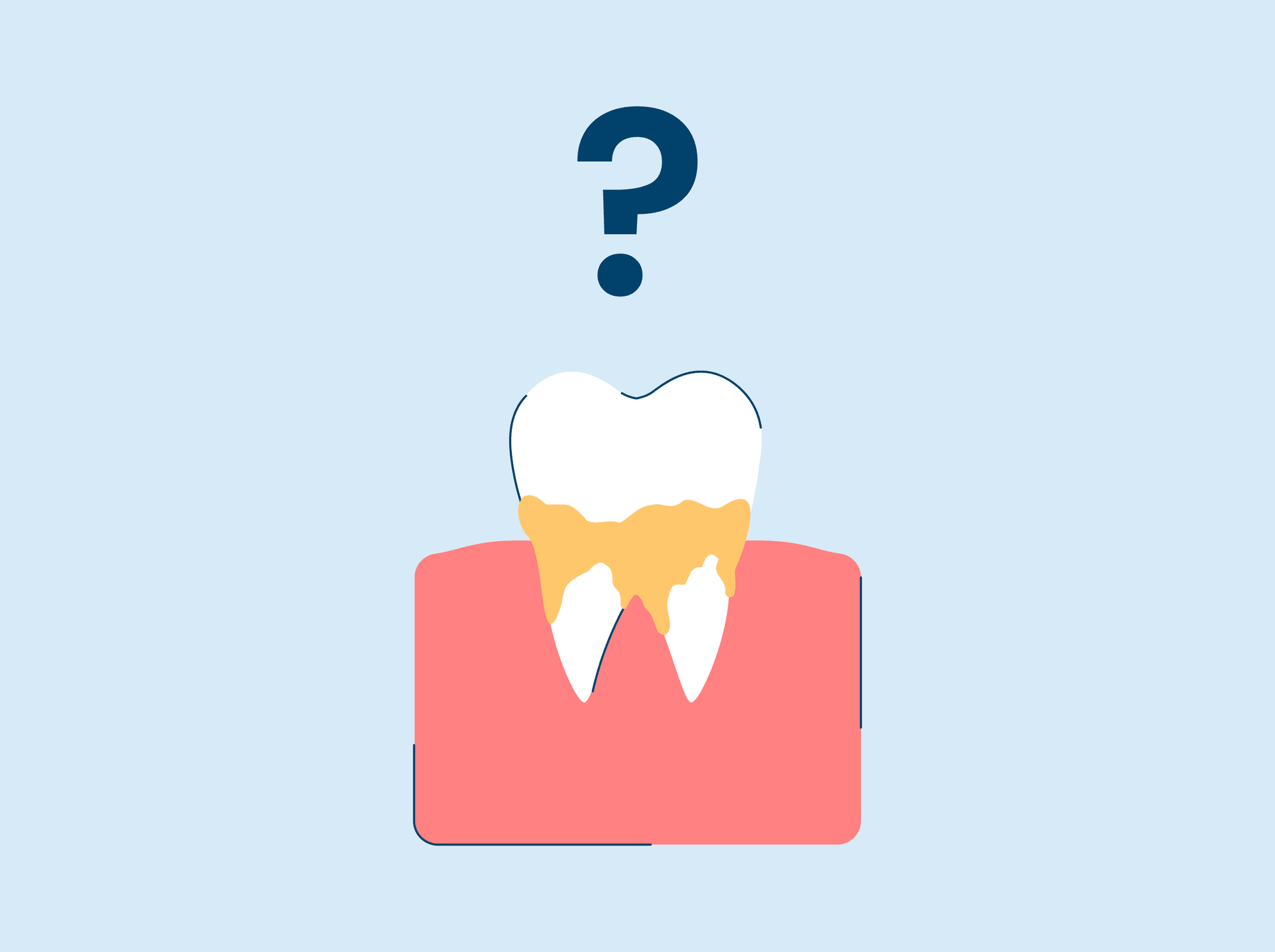 Calcium Deposits on Teeth: Everything You Need To Know [Updated 2026]