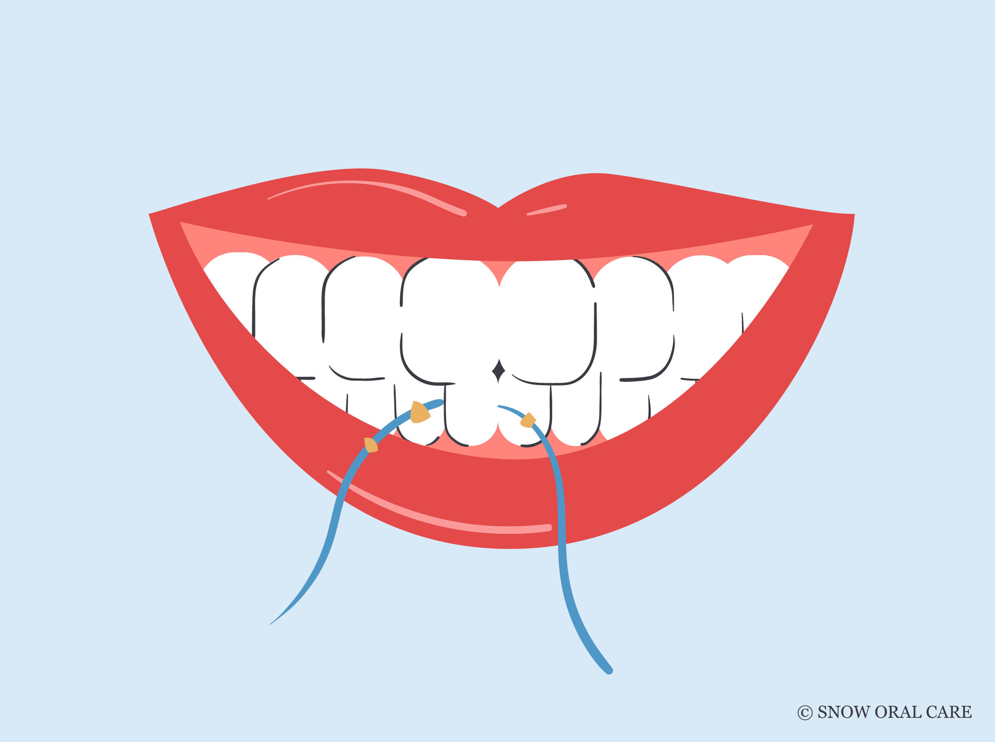 what are the benefits of flossing