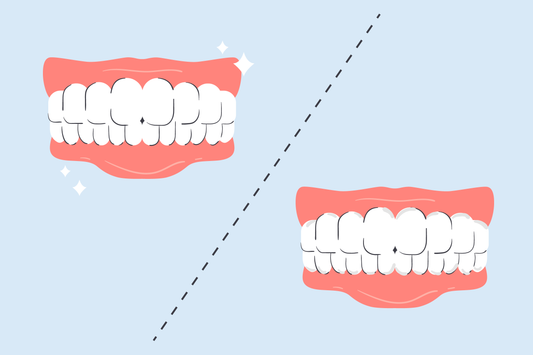 what happens if you don't floss