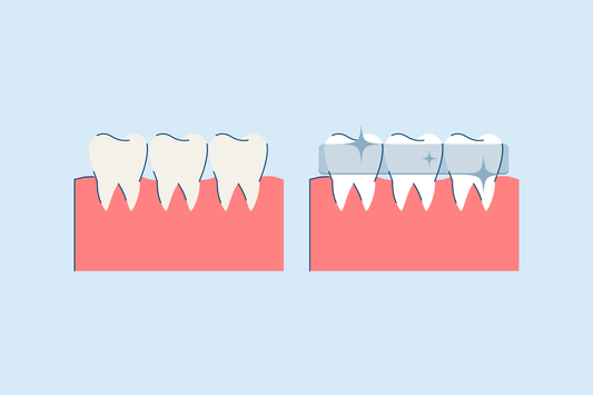 what is teeth whitening