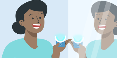what to do after teeth whitening 