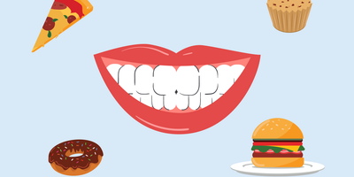 what to eat after teeth whitening 