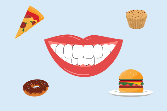 what to eat after teeth whitening 