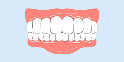 white line on gums below teeth 