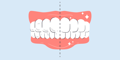 white specks on teeth