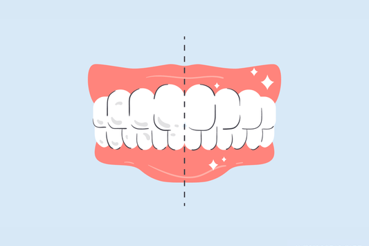 white specks on teeth