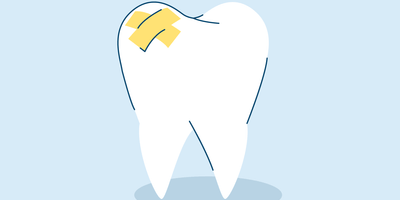 white spots on teeth after whitening