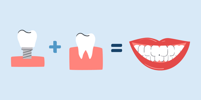 whitening fake and real teeth together 