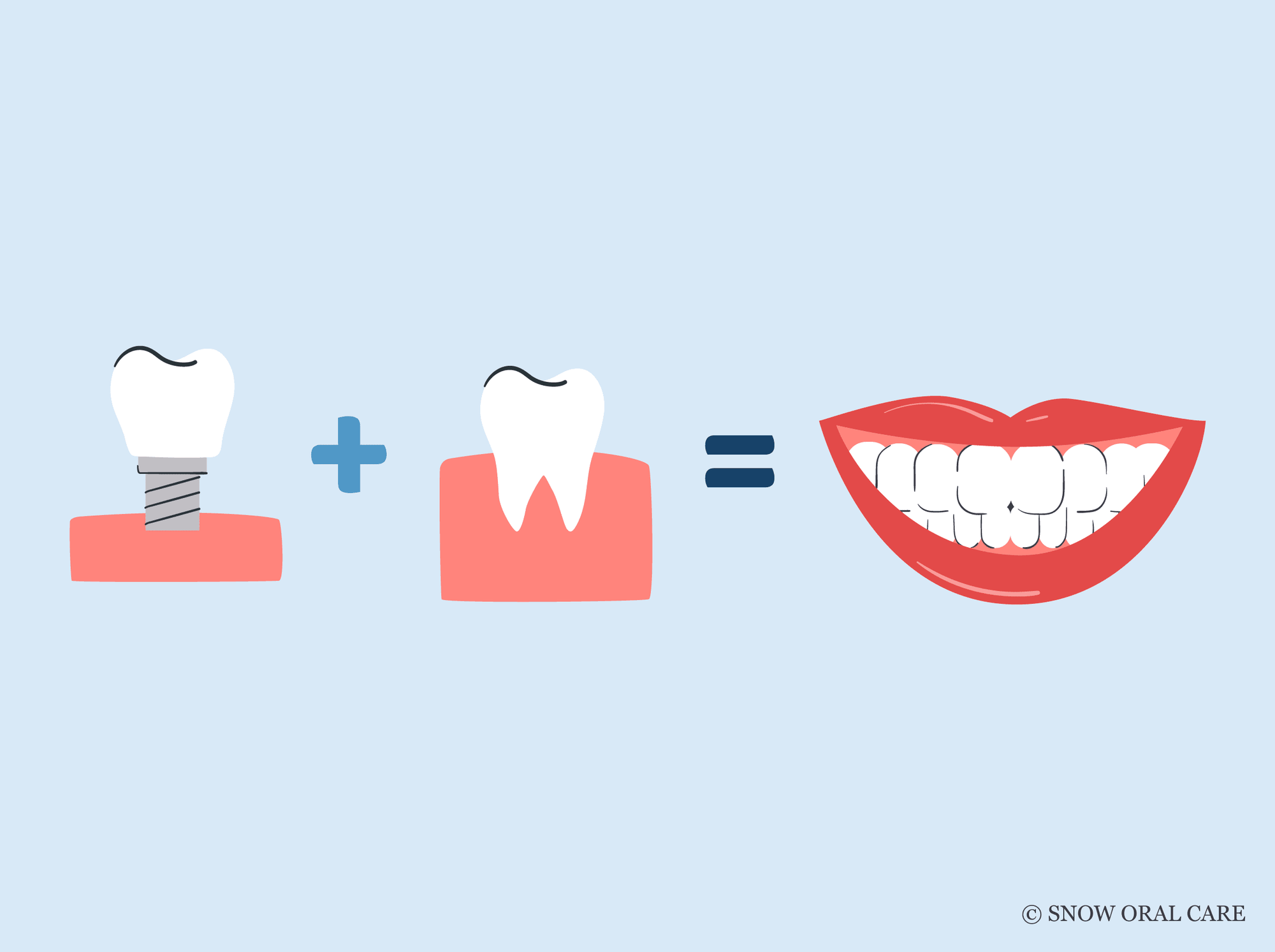 whitening fake and real teeth together 