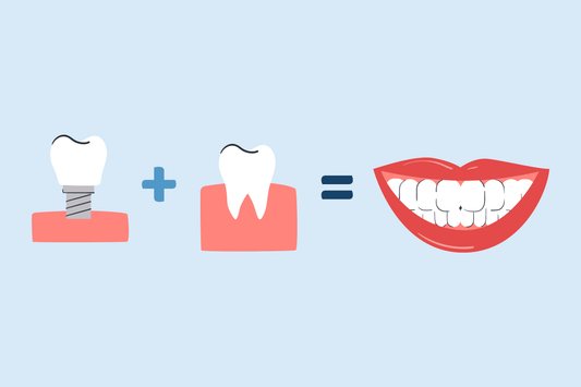 whitening fake and real teeth together 