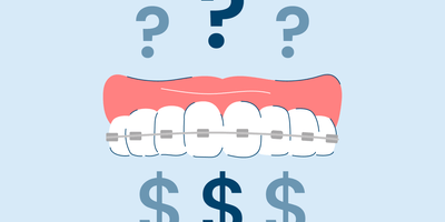 why are braces so expensive
