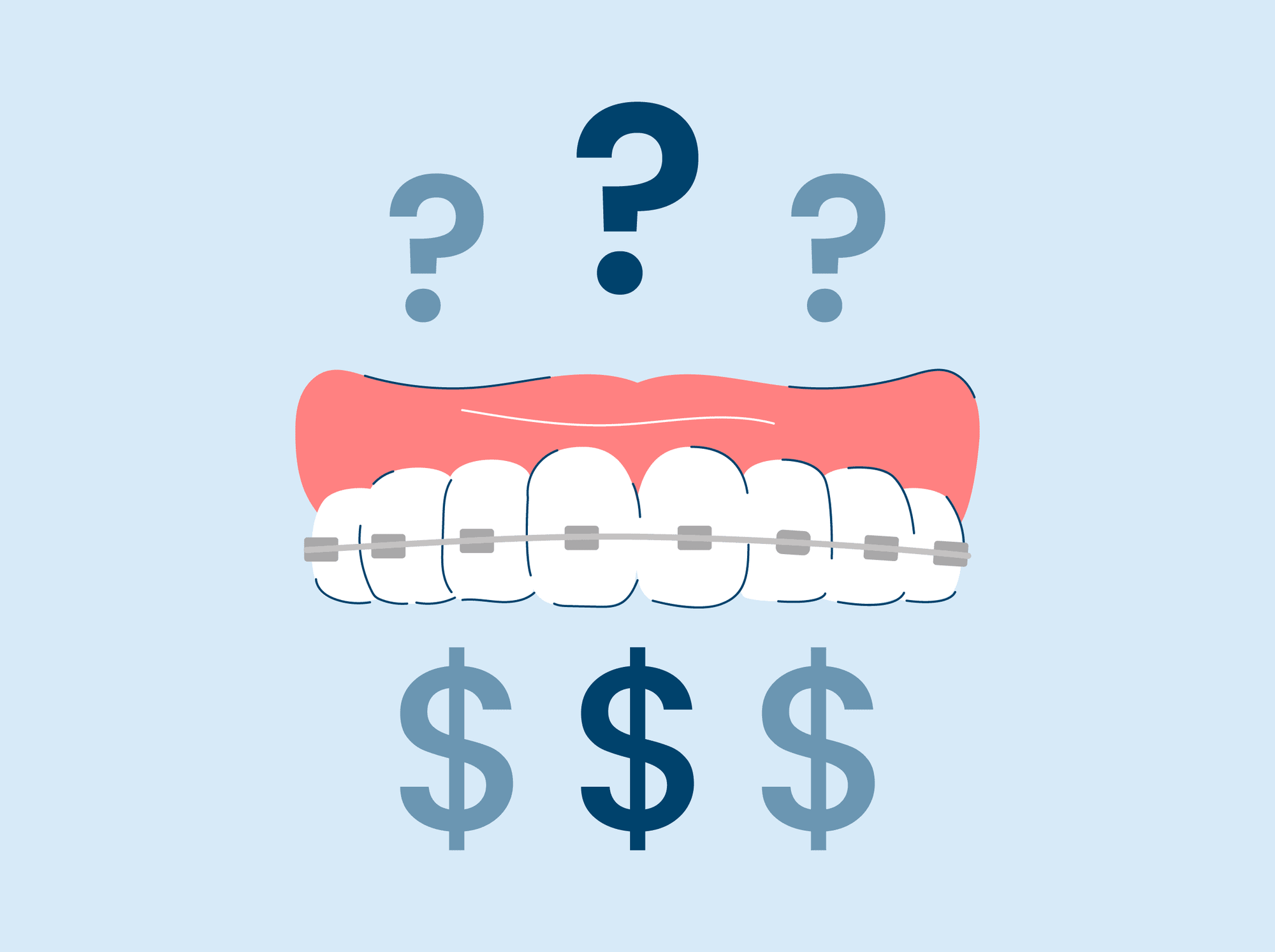 why are braces so expensive