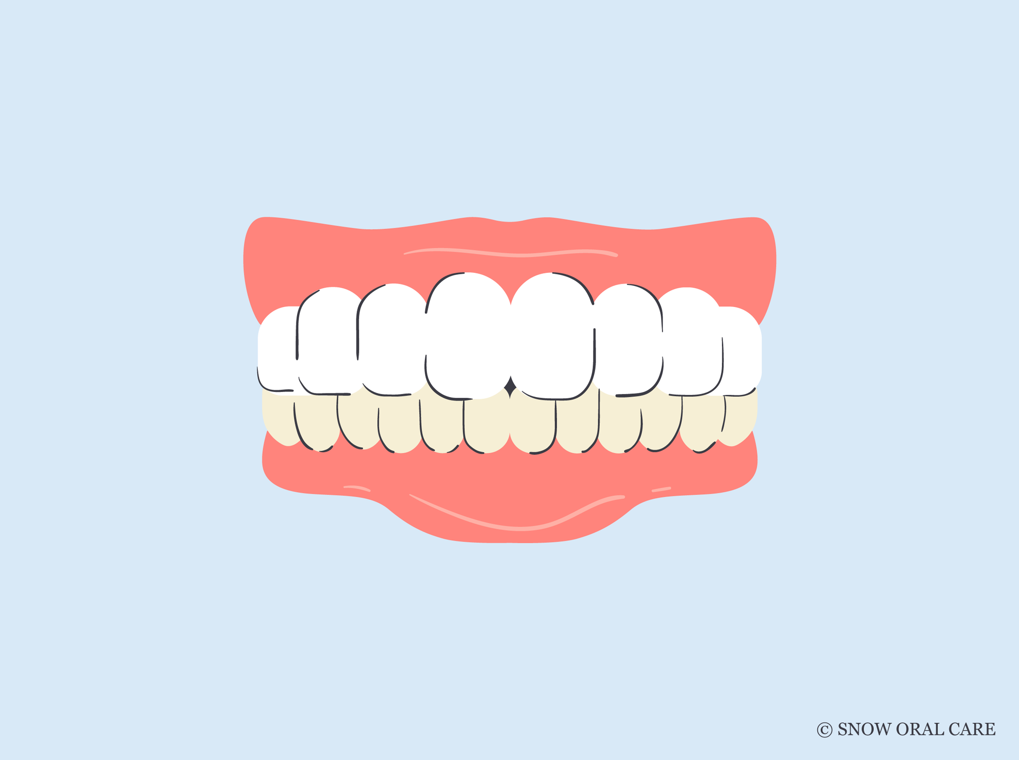why are my bottom teeth more yellow 