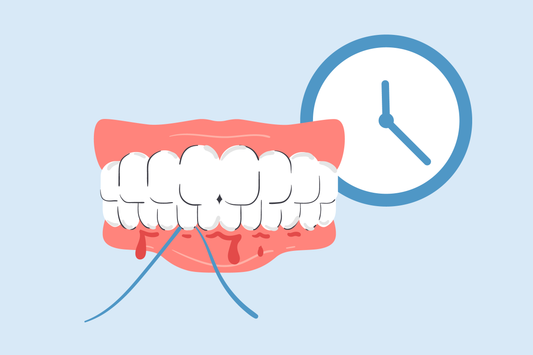 why do gums bleed after not flossing for a while