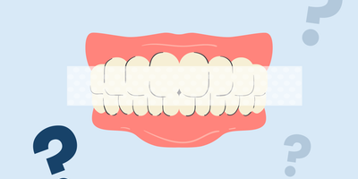 why do my teeth look more yellow after whitening strips 