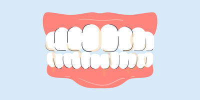 why is my spit yellow when i brush my teeth 