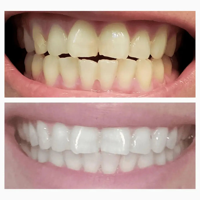 SNOW® Teeth Whitening Powder with Hydroxyapatite | 3 Pack