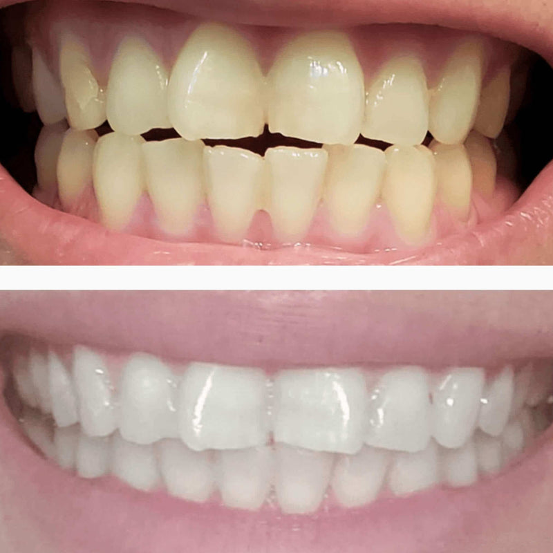 SNOW® Overnight Sensitive Teeth Whitening Pen | Hydroxyapatite