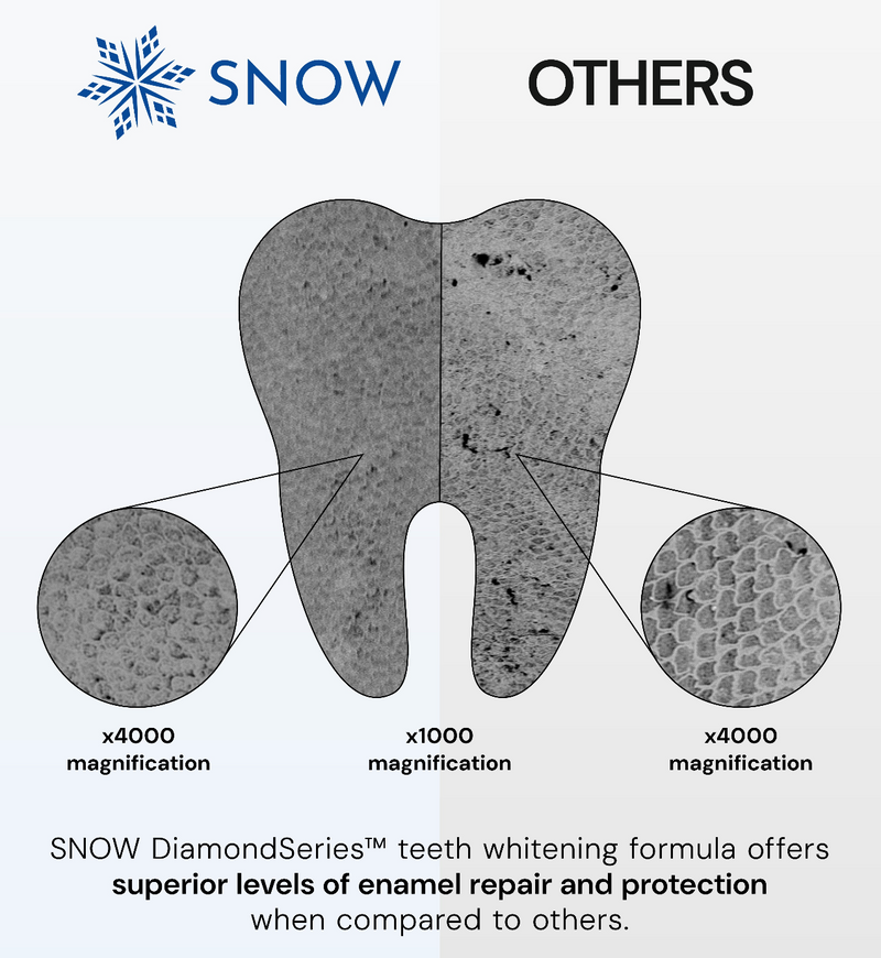 DiamondSeries® Wireless LED Teeth Whitening Kit with Hydroxyapatite & Patented Self-Sanitizing Case