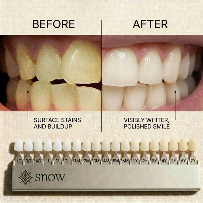Magic Teeth Whitening Powder®
