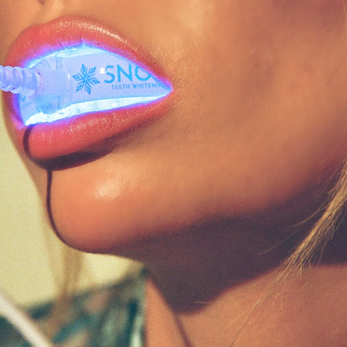 SNOW® Diamond Series Teeth Whitening Kit | Professional Whitening at Home (1 Serum)
