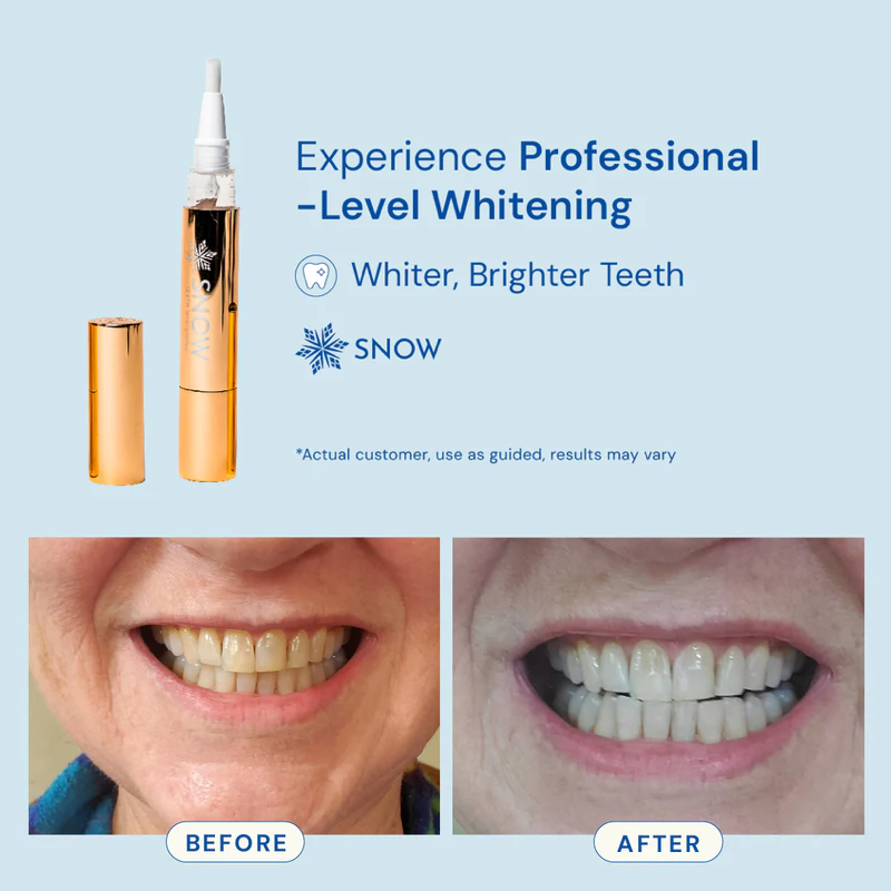 Extra-Strength Teeth Whitening Gold Serum Pen - Dual-Peroxide Formula & Xylitol