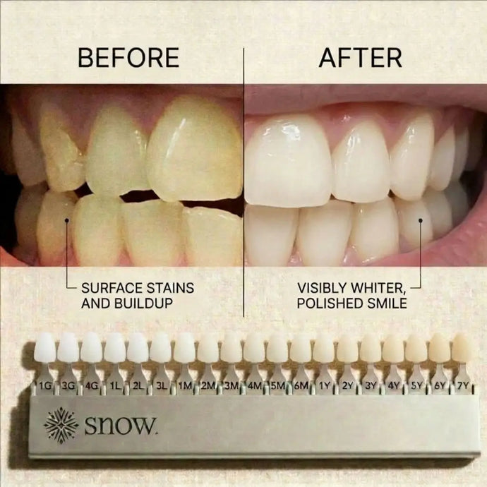 Magic Teeth Whitening Powder®